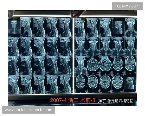 风间敏晨臣CT扫描显示头颈无结构性损伤，当晚出院